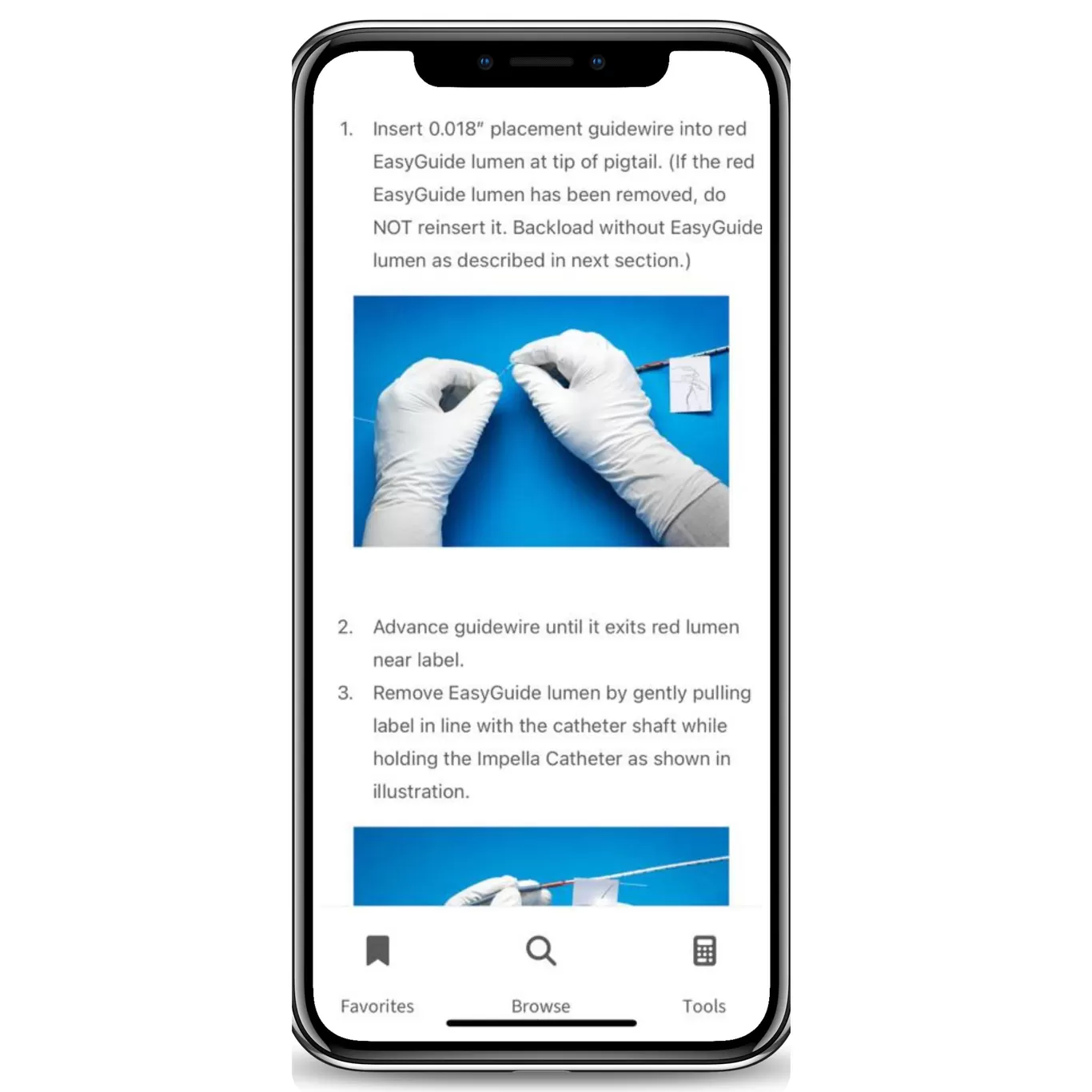 Impella Clinical Care App Article