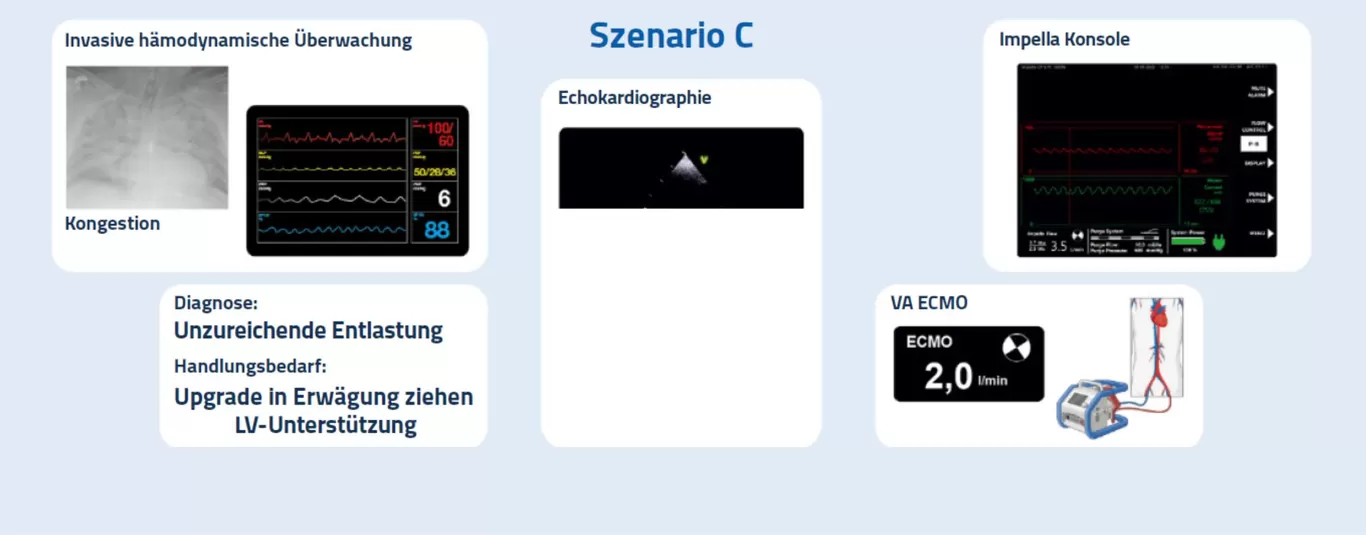 Monitoring auf der Intensivstation - Szenario C