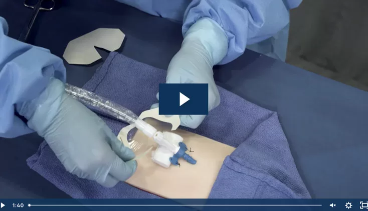Impella® Skills Video: Changing the Femoral Access Site Dressing in the ICU
