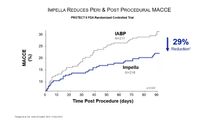 Intra-aortic Balloon Pump (IABP) FAQs
