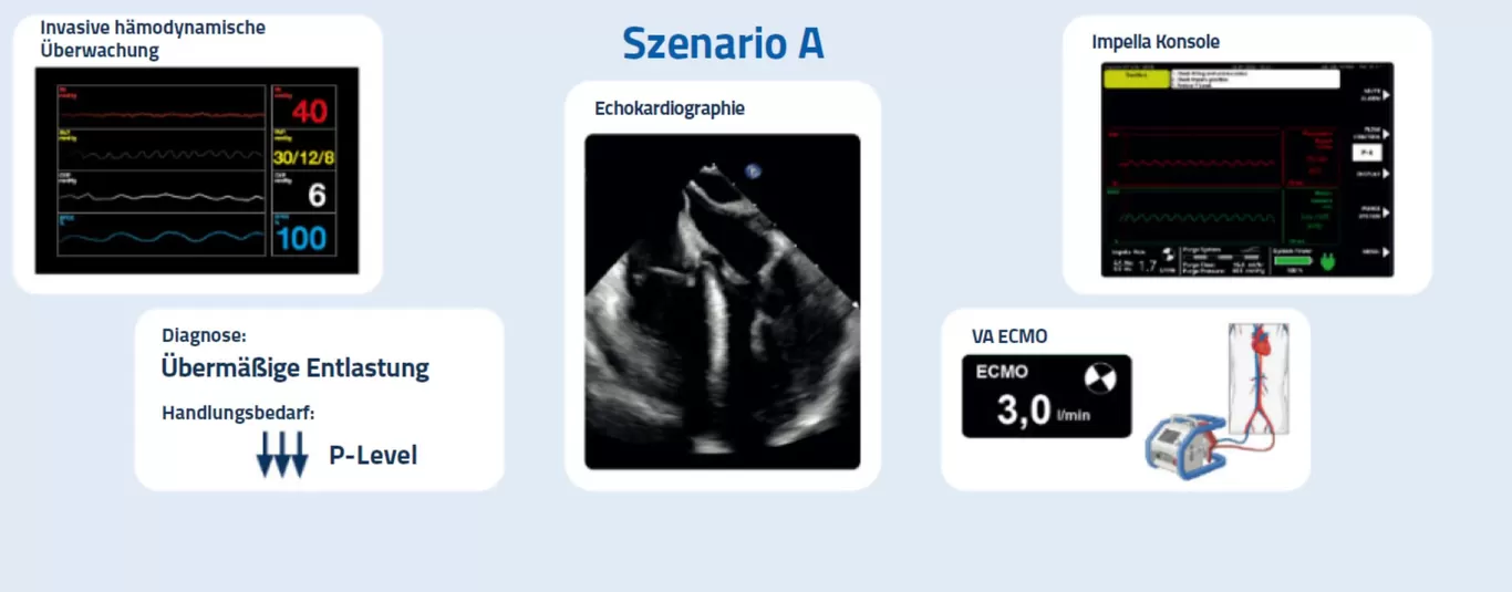 Monitoring auf der Intensivstation - Szenario A
