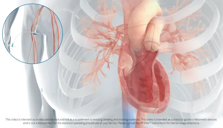Impella RP Flex<sup>™</sup> with SmartAssist<sup>™</sup> Insertion Animation