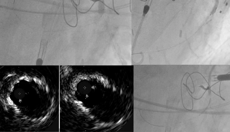 Heart imaging in form of echocardiography and fluoroscopy