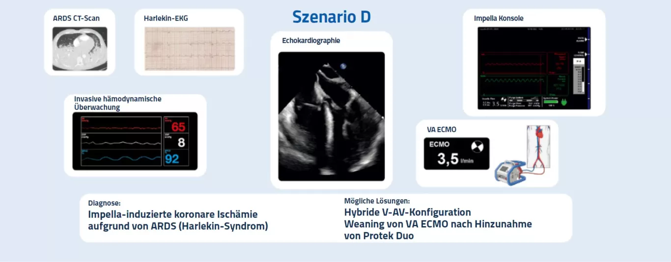 Monitoring auf der Intensivstation - Szenario D